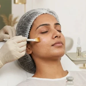 Biorepeel in Bangalore Clinical Assessment & Treatment - Dermis 365 Bengaluru