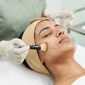 Chemical Peel - Resurfacing in Bangalore Clinical Assessment & Treatment - Dermis 365 Bengaluru