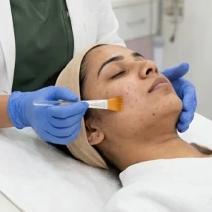 Salicylic Acid Peel in Bangalore Clinical Assessment & Treatment - Dermis 365 Bengaluru