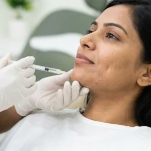 Chin Dimpling Treatment in Bangalore Clinical Assessment & Treatment - Dermis 365 Bengaluru
