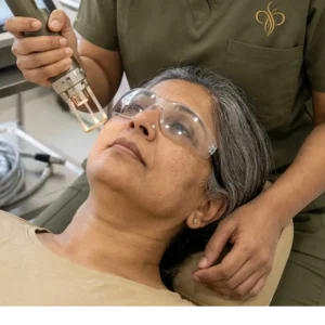 Fractional CO2 Laser Resurfacing in Bangalore Clinical Assessment & Treatment - Dermis 365 Bengaluru