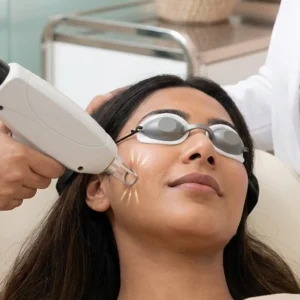 Laser Skin Lightening in Bangalore Clinical Assessment & Treatment - Dermis 365 Bengaluru