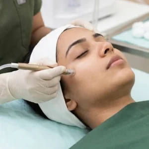 Microdermabrasion in Bangalore Clinical Assessment & Treatment - Dermis 365 Bengaluru