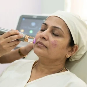 Non-Ablative Fractional Laser in Bangalore Clinical Assessment & Treatment - Dermis 365 Bengaluru