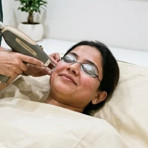 Picosecond Laser in Bangalore Clinical Assessment & Treatment - Dermis 365 Bengaluru