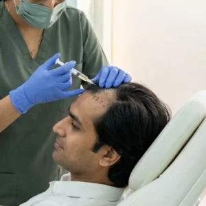 PRP - Scalp Alopecia in Bangalore Clinical Assessment & Treatment - Dermis 365 Bengaluru