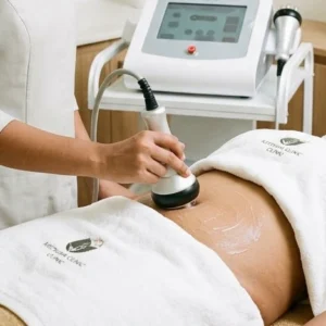 RF Cavitation in Bangalore Clinical Assessment & Treatment - Dermis 365 Bengaluru