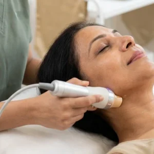 RF Neck & Chin Tightening in Bangalore Clinical Assessment & Treatment - Dermis 365 Bengaluru