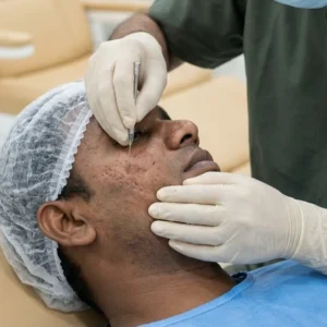 Subcision in Bangalore Clinical Assessment & Treatment - Dermis 365 Bengaluru