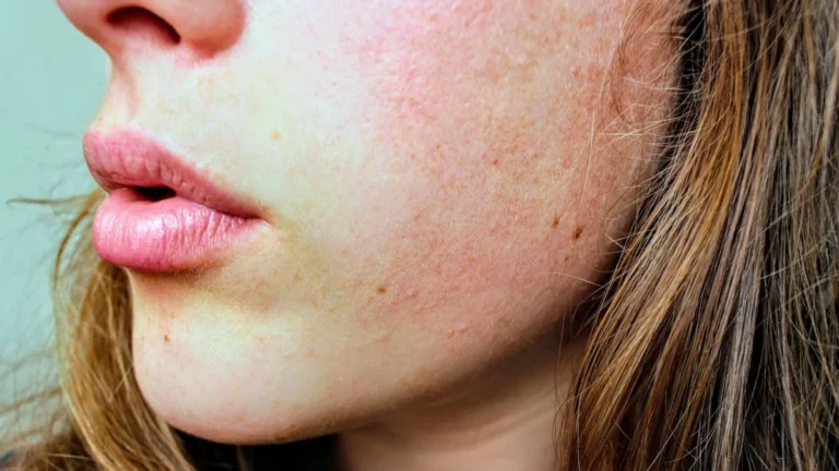Home Remedies for Dark Spots on Face: Safe Tips for Clearer-Looking Skin