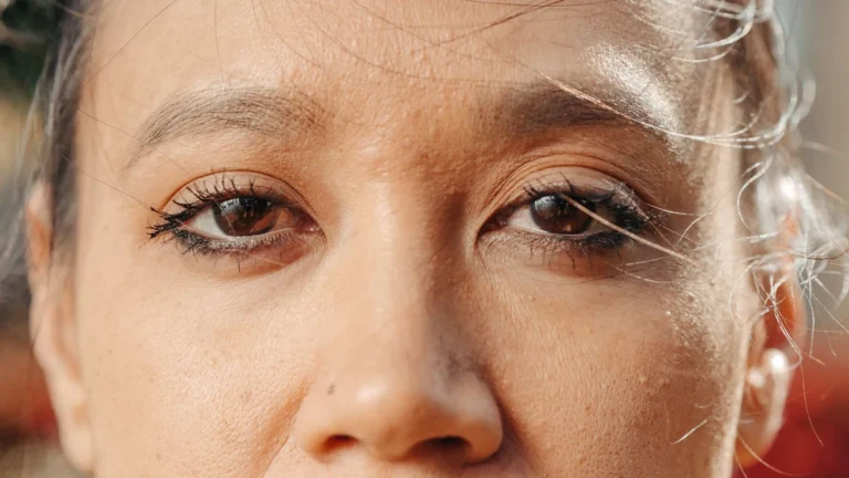 Dark Circles Under Eyes Treatment: Causes, Remedies & Effective Options